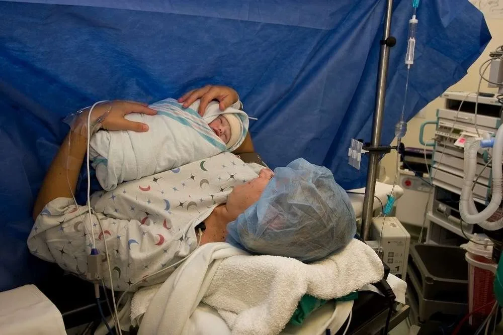 Common Myths & Misconceptions About C-Section Deliveries