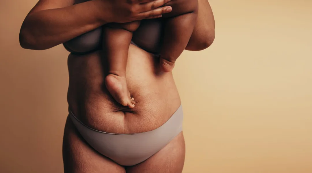 Postpartum Body Changes